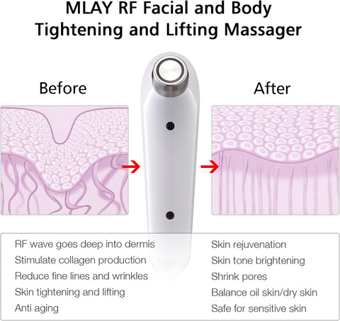 MLAY RF Beauty Device for Face and Body, Home RF Lifting, Wrinkle Removal, Anti Aging, Skin Tightening, Increase Collagen & Absorption