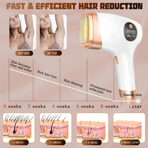 IPL Laser Hair Removal Device for Home Use, Ice Cooling Painless, 5 Energy Levels, 999,999 Flashes